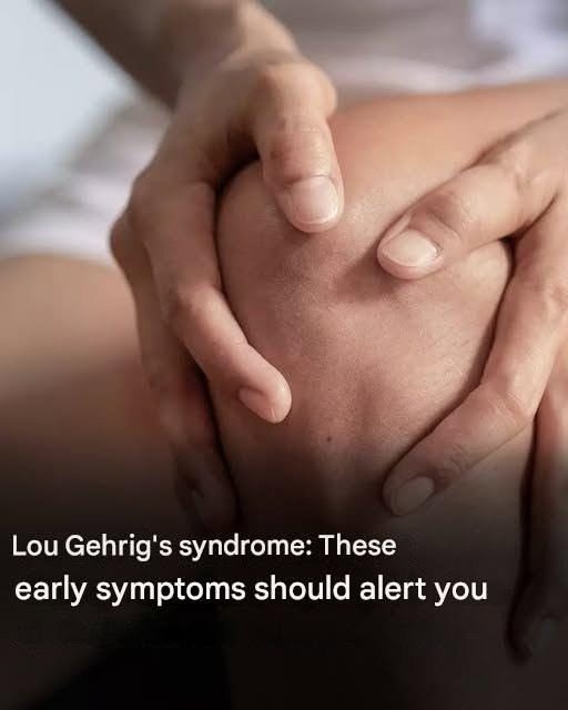 Lou Gehrig’s Syndrome: Understanding the Early Symptoms of ALS 819012165_122192355272772066_5009310009112293184_n