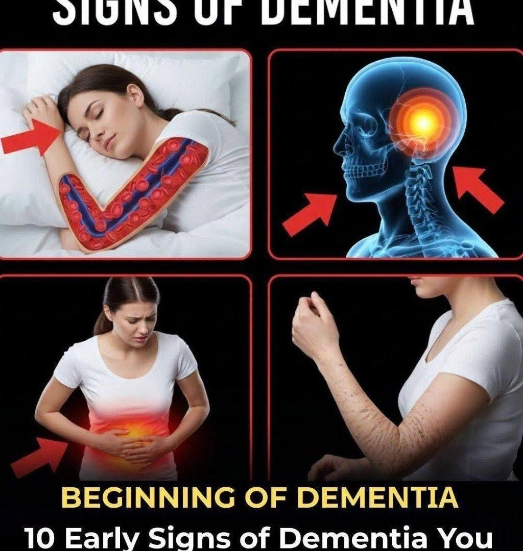 10 Early Signs of Dementia You Should Never Ignore image